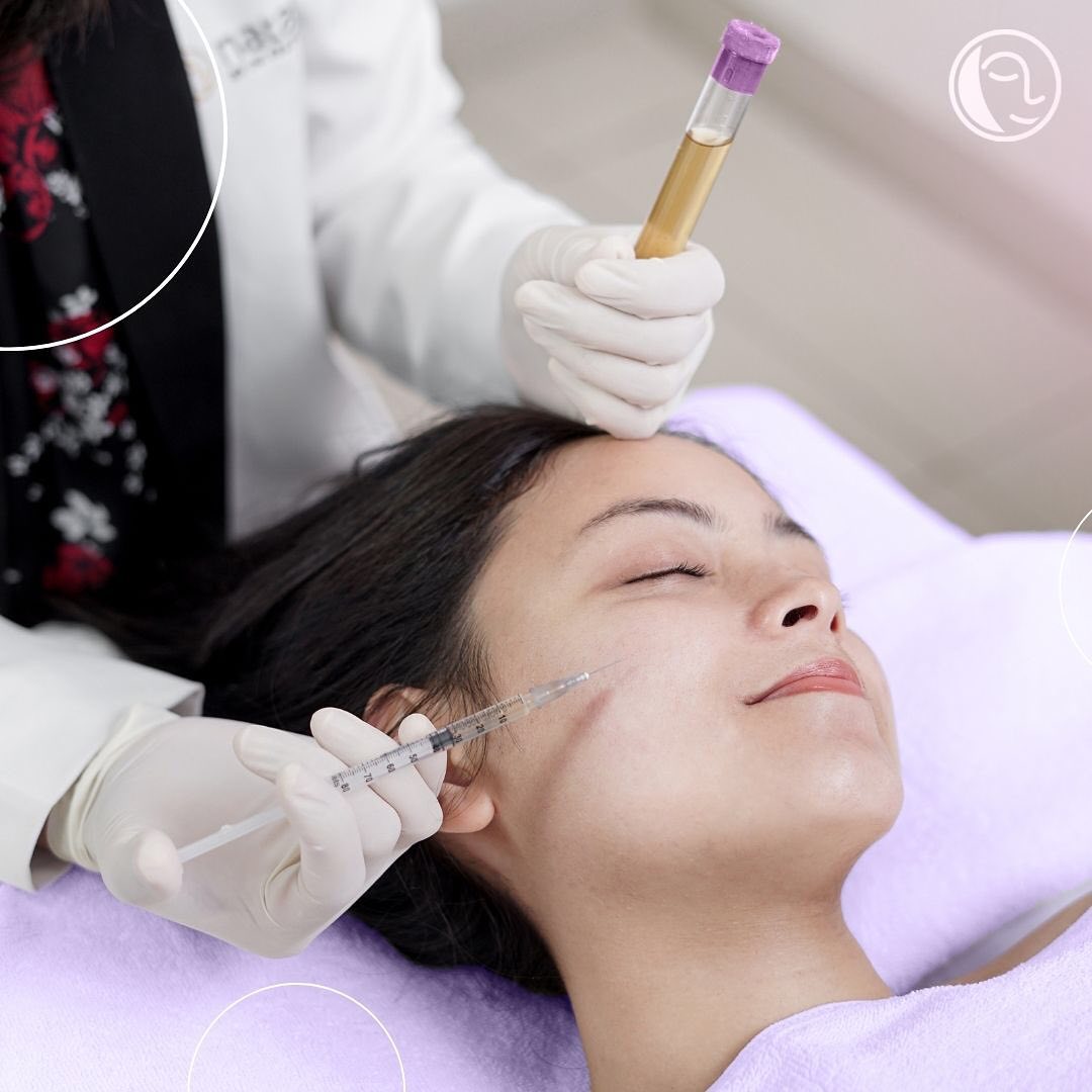 NATASHA PLATELET RICH PLASMA (PRP)